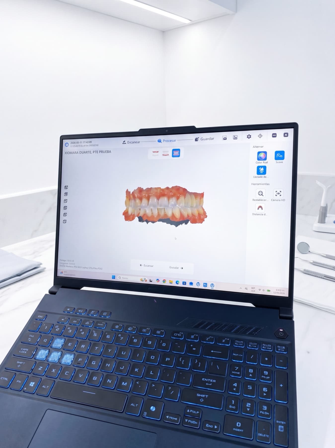 Procedimiento dental con tecnología digital - Odonto Sonrie Ocaña