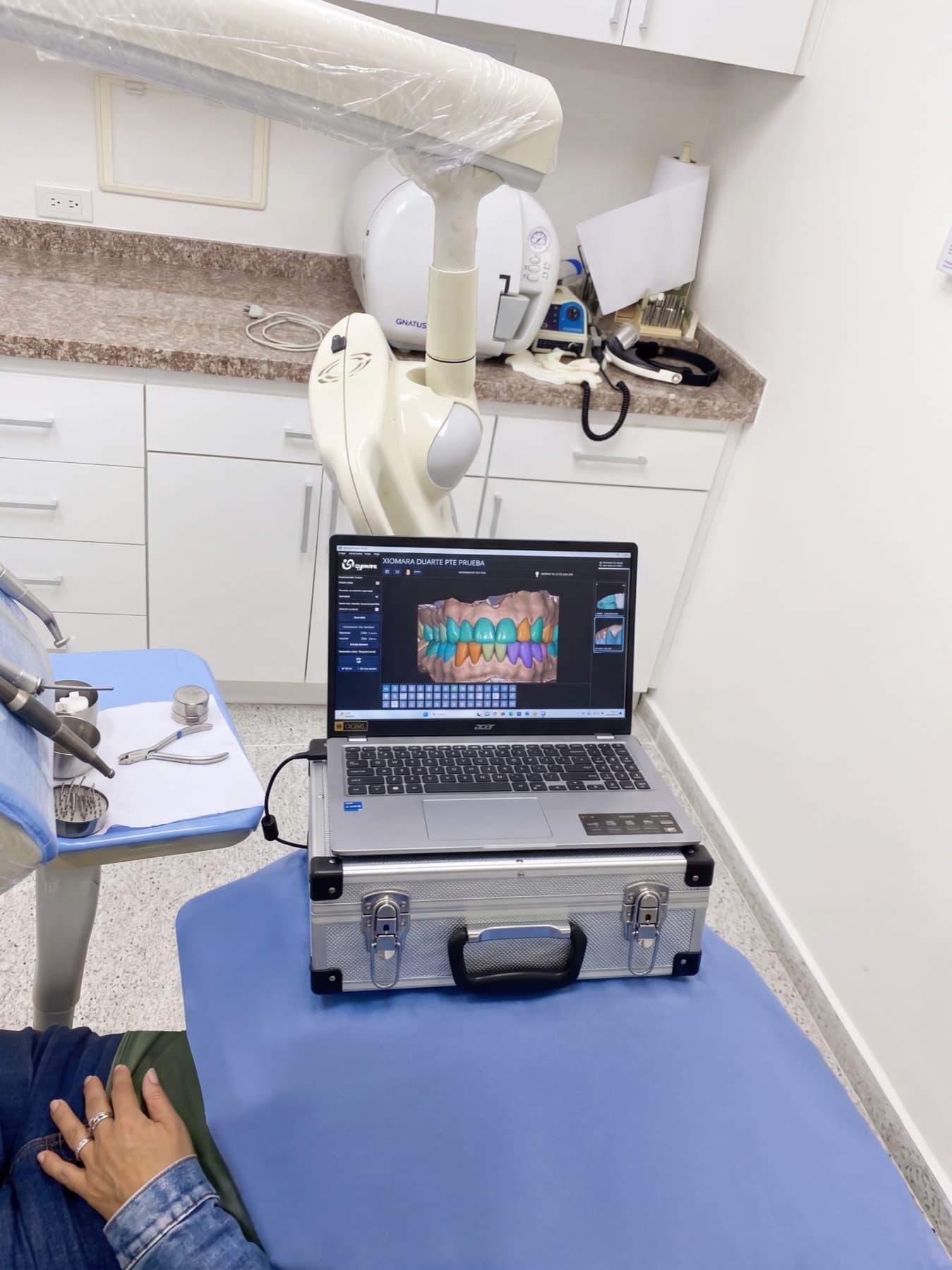 Escaneo 3D intraoral mostrando los dientes en pantalla - Odontología digital Ocaña